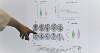 Cambios cerebrales