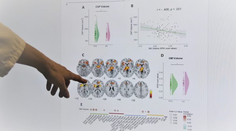 Cambios cerebrales