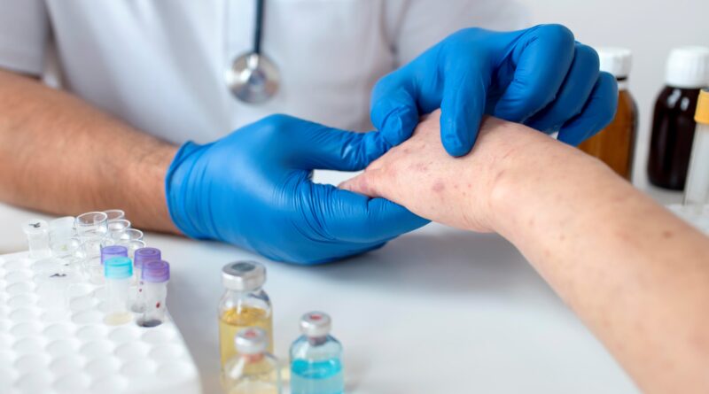 terapia biológica