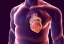 Insuficiencia cardiaca (IC)