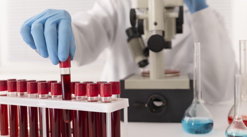 de Hematología