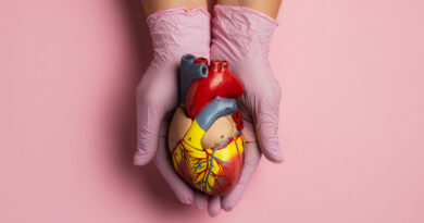 Miocardiopatía dilatada