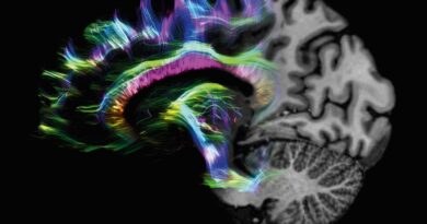 Las técnicas de imagen médica abren nuevas vías para detectar el Alzhéimer en fases preclínicas