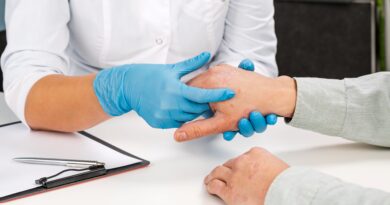 dermatitis atópica grave