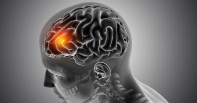 Daño cerebral