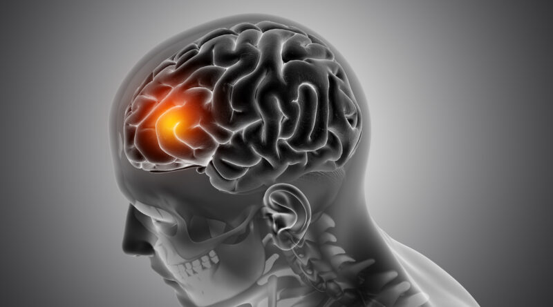 Daño cerebral