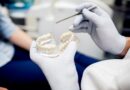 implantes dentales