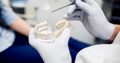implantes dentales