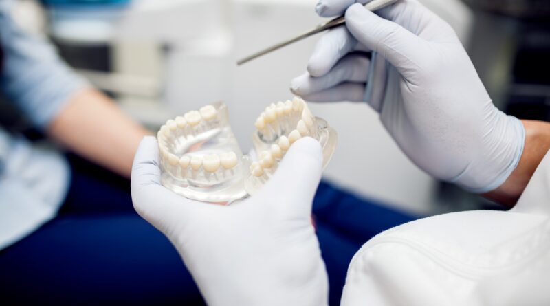 implantes dentales