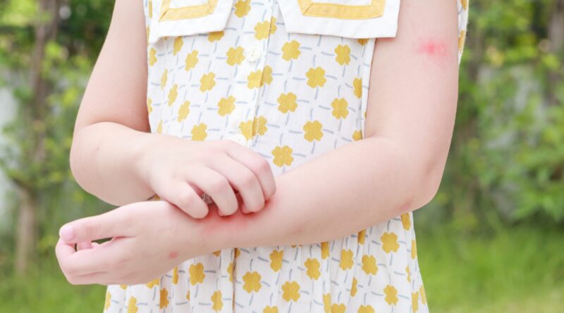 reacciones alérgicas